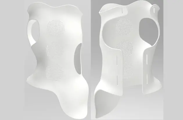 Customized Spinal Orthosis Customized Spinal Orthosis