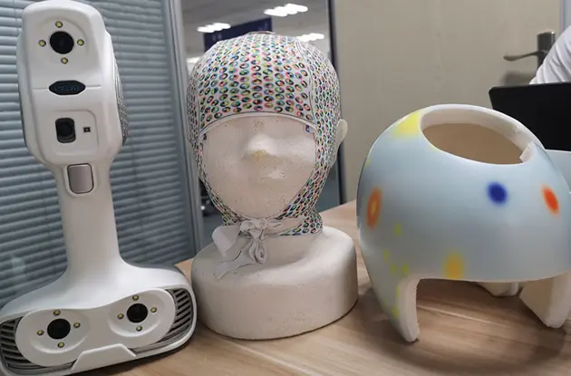 Baby's Plagiocephaly Helmet Baby's Plagiocephaly Helmet